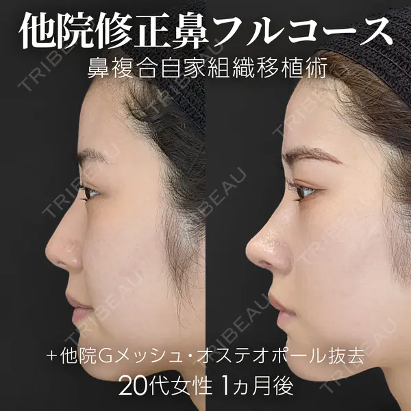 ジョウクリニック 銀座院 重本　譲医師の症例