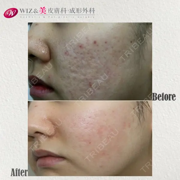WIZ＆美 美容外科・皮膚科の症例