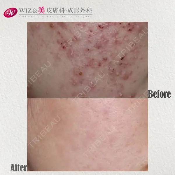 WIZ＆美 美容外科・皮膚科の症例