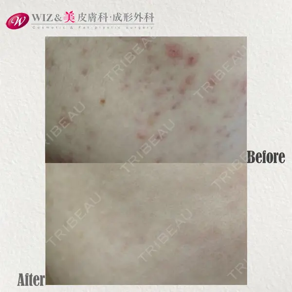 WIZ＆美 美容外科・皮膚科の症例