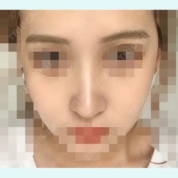 加美（GAMI）整形外科 パク・ゴヌク医師の症例