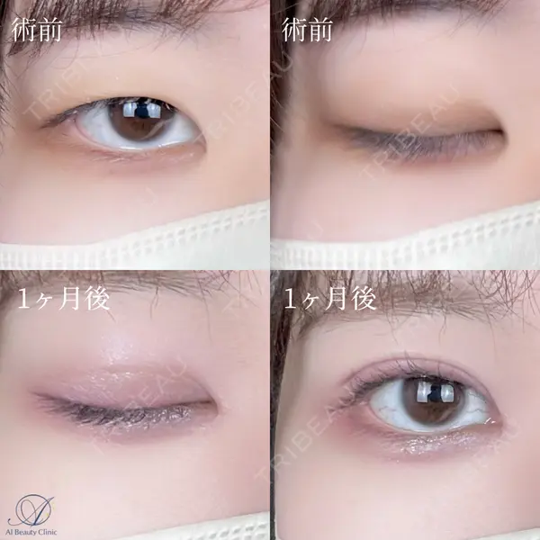 AI Beauty Clinic （エーアイ美容クリニック） 尾崎 宥文医師の症例