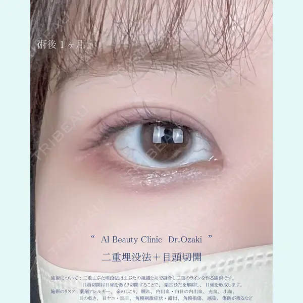 AI Beauty Clinic （エーアイ美容クリニック） 尾崎 宥文医師の症例