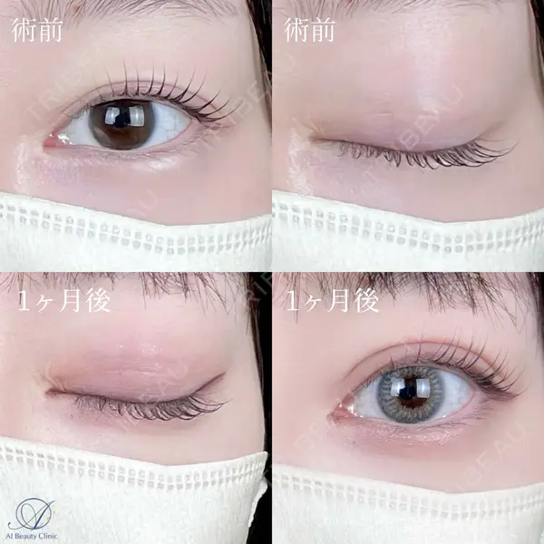 AI Beauty Clinic （エーアイ美容クリニック） 尾崎 宥文医師の症例