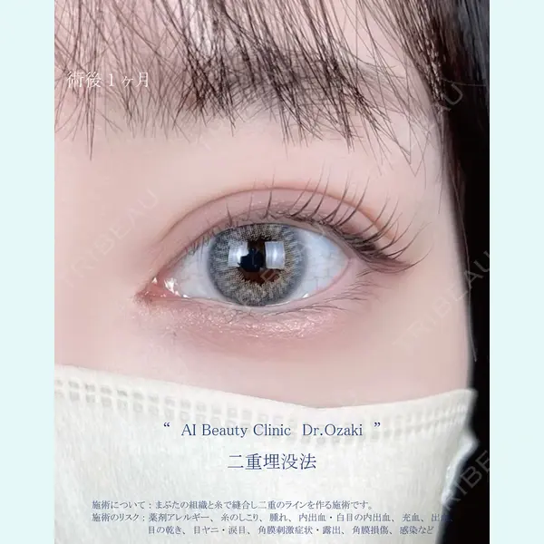 AI Beauty Clinic （エーアイ美容クリニック） 尾崎 宥文医師の症例
