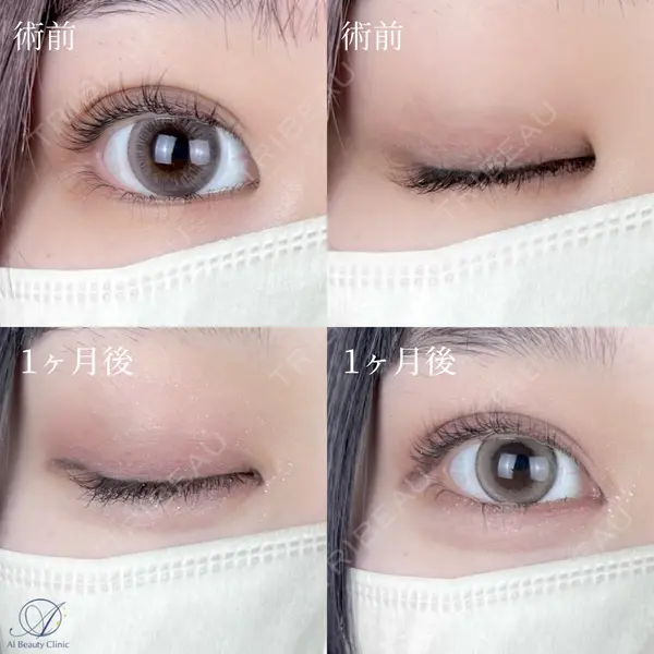 AI Beauty Clinic （エーアイ美容クリニック） 尾崎 宥文医師の症例