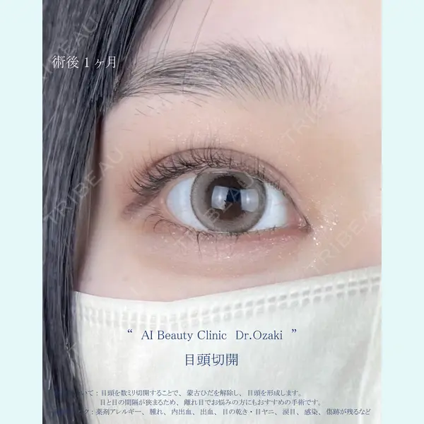 AI Beauty Clinic （エーアイ美容クリニック） 尾崎 宥文医師の症例