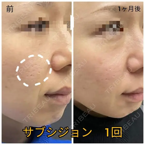 ゆきスキンクリニック 東池袋 小林 智之医師の症例
