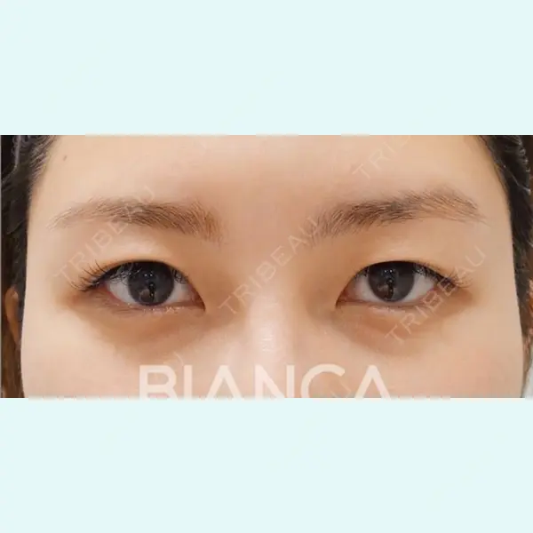 BIANCA銀座 堀田 和亮医師の症例