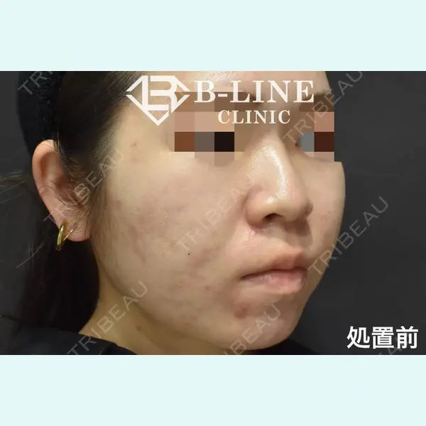 B-LINE CLINIC 池袋院 小池 康弘医師の症例