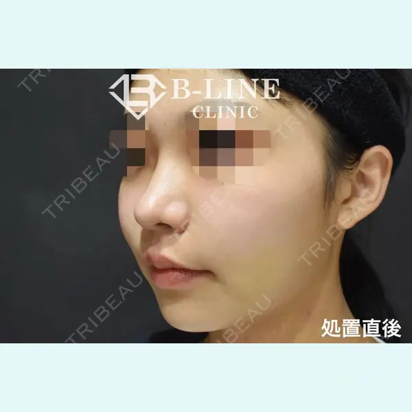 B-LINE CLINIC 池袋院 小池 康弘医師の症例