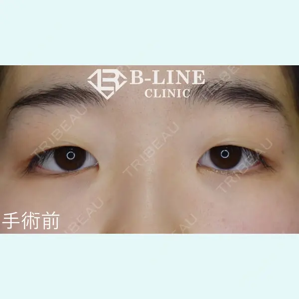 B-LINE CLINIC 池袋院 小池 康弘医師の症例