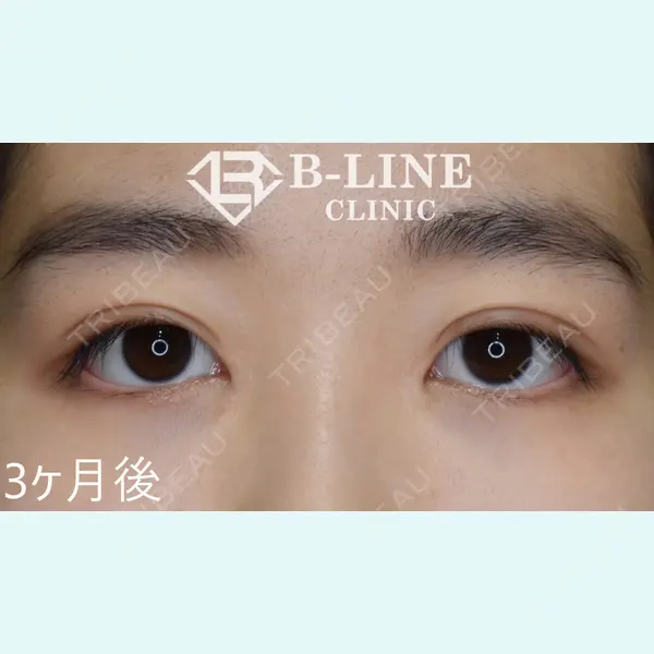 B-LINE CLINIC 池袋院 小池 康弘医師の症例
