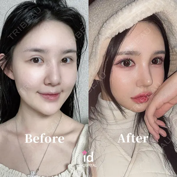 id（アイディ）美容外科の症例