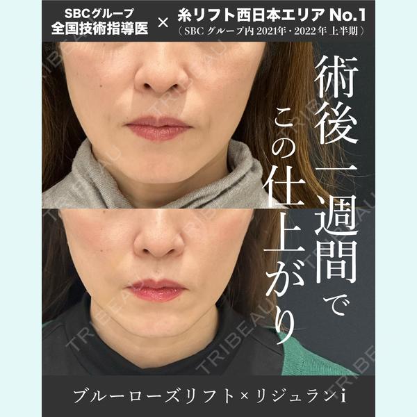 湘南美容クリニック 大阪四ツ橋院 植田 一樹医師の症例
