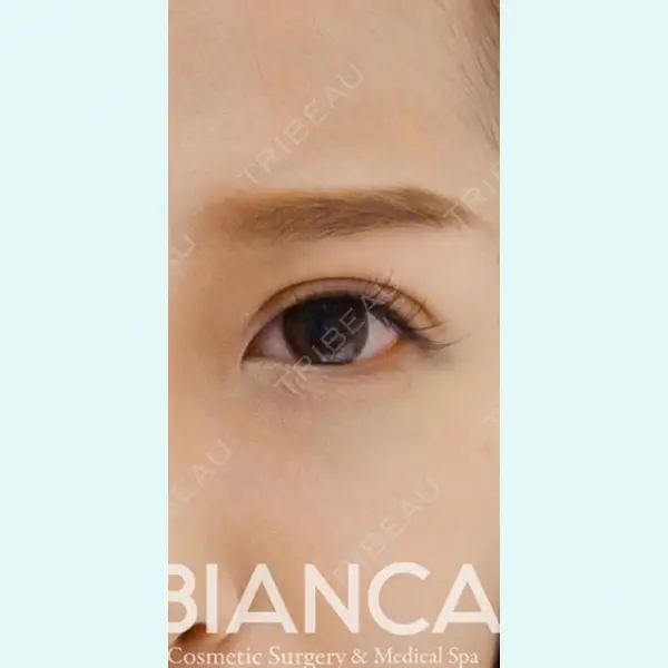 BIANCA銀座 堀田 和亮医師の症例