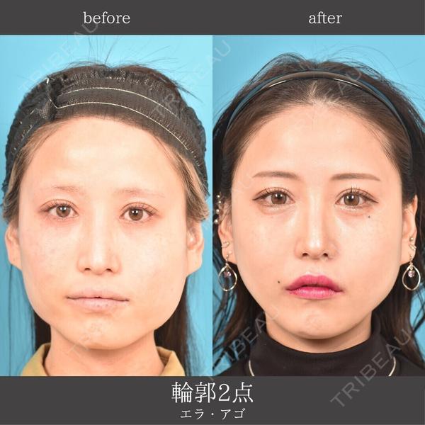 アネシス美容クリニック 水野　力医師の症例