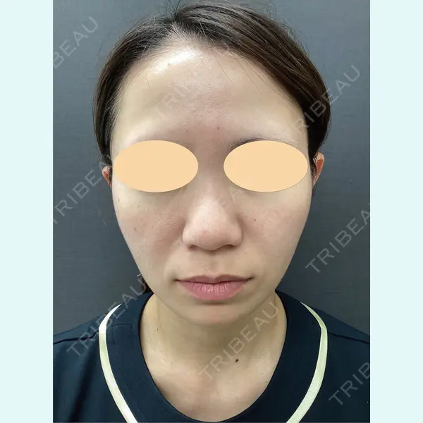 lime clinic （杏クリニック）の症例