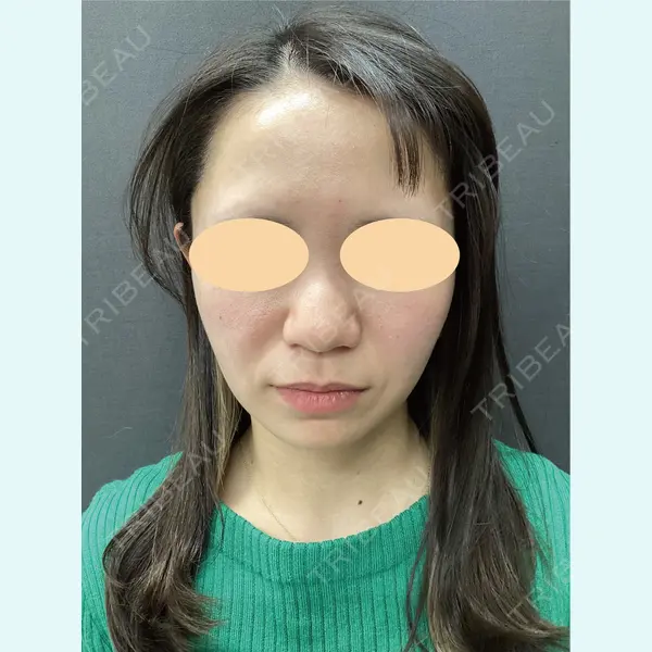 lime clinic （杏クリニック）の症例