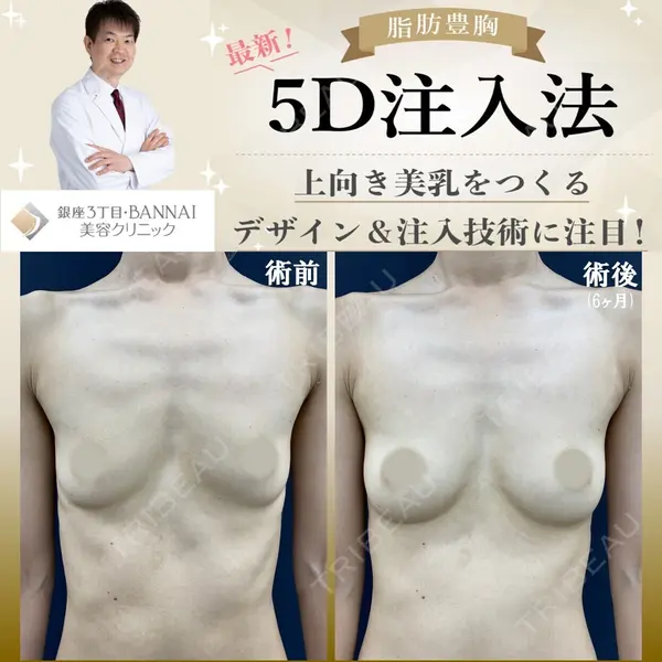 銀座3丁目・BANNAI美容クリニック 坂内 将佑貴医師の症例