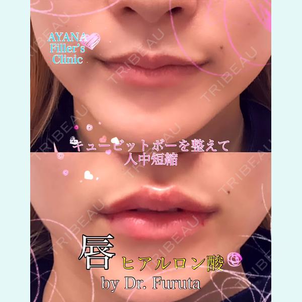 AYANAフィラーズクリニック 渋谷院 古田 晃医師の症例