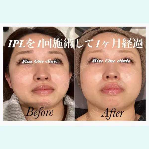 心斎橋KT美容クリニックの症例