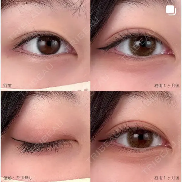 湘南美容クリニック 千葉センシティ院の症例
