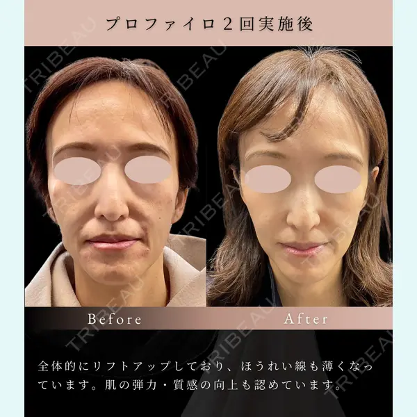 スマートスキンクリニック 横浜院の症例