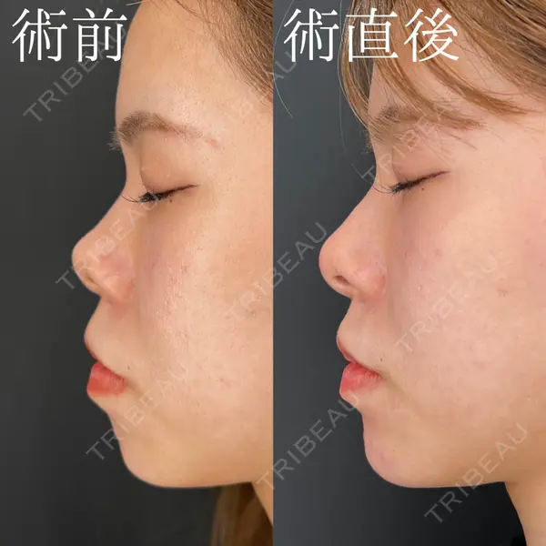 HAAB×DREAM BEAUTY CLINIC 大阪梅田院 柏木 太雅医師の症例