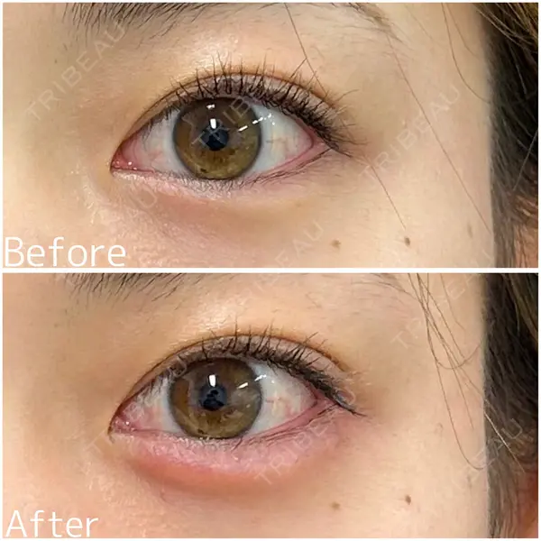 ファイヤークリニック 銀座院 高山 泰享医師の症例