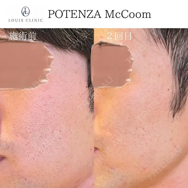 LOUIS CLINIC 二子玉川院【ルイクリニック】 小松 塁医師の症例