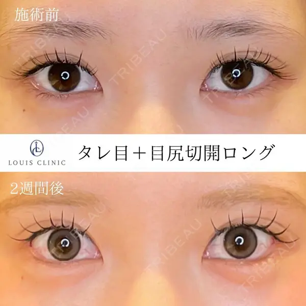 LOUIS CLINIC 二子玉川院【ルイクリニック】 小松 塁医師の症例
