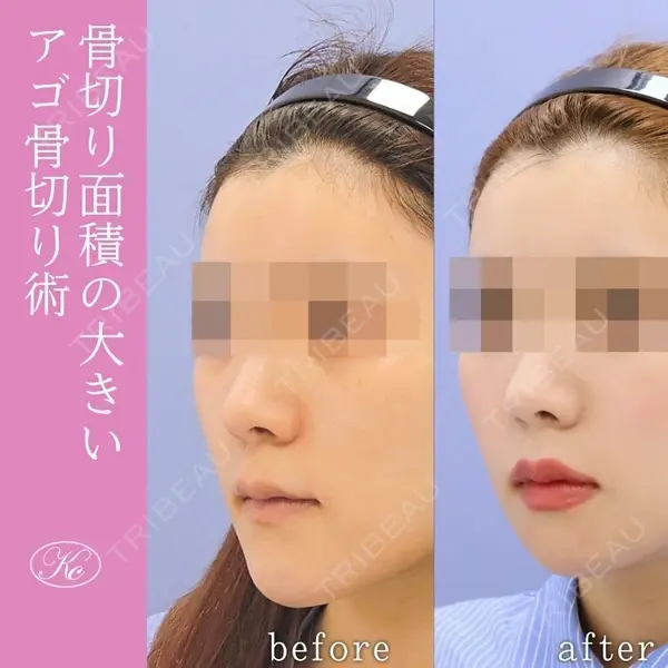 小木曽クリニック 小木曽 祐一医師の症例