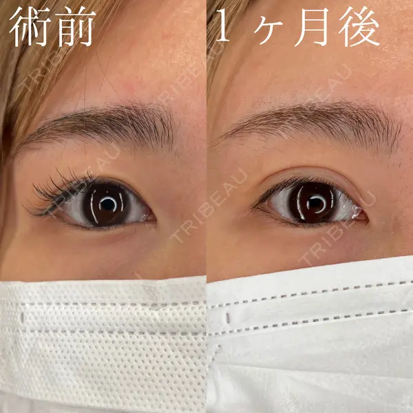 HAAB×DREAM BEAUTY CLINIC 大阪梅田院 柏木 太雅医師の症例