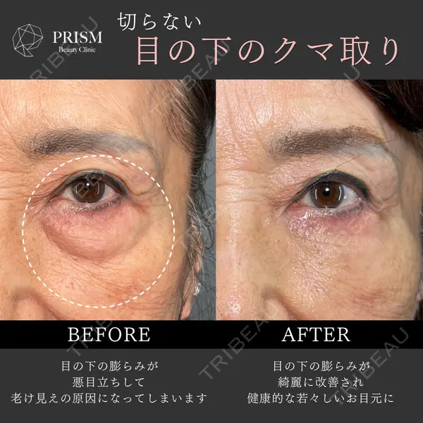 PRISM Beauty Clinic 新宿院 畑山 知輝医師の症例