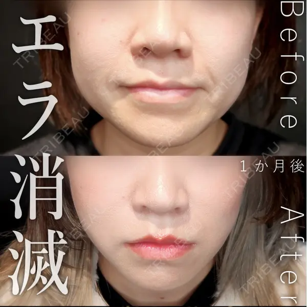 Tokyo Tensei Clinic 新宿院 辻 大成医師の症例