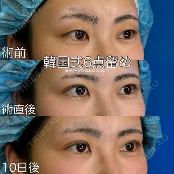 城本クリニック 水戸院の症例