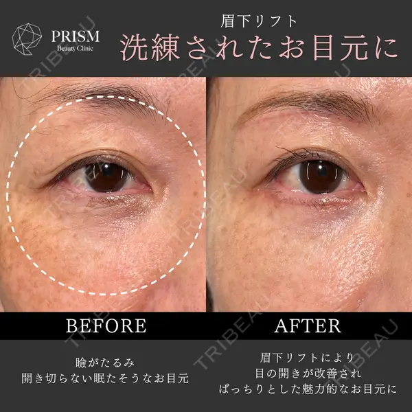 PRISM Beauty Clinic 新宿院 畑山 知輝医師の症例