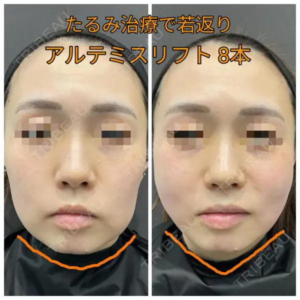 ゆきスキンクリニック 東池袋 小林 智之医師の症例