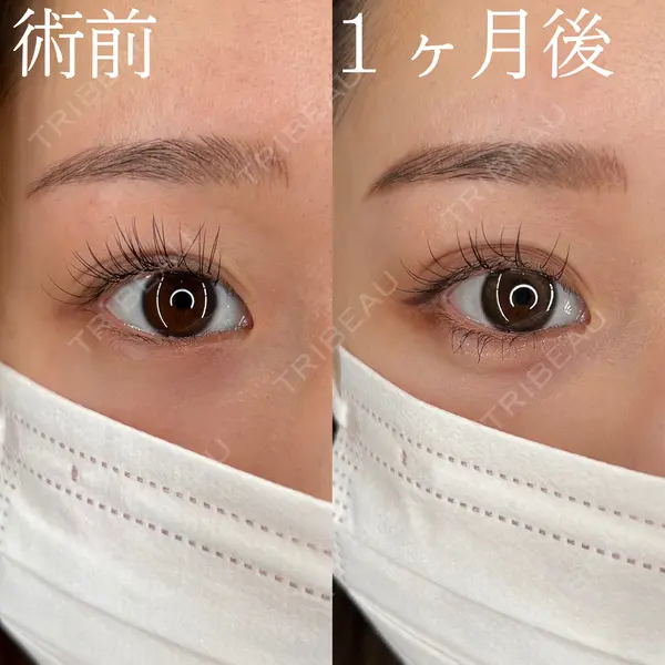 HAAB×DREAM BEAUTY CLINIC 大阪梅田院 柏木 太雅医師の症例