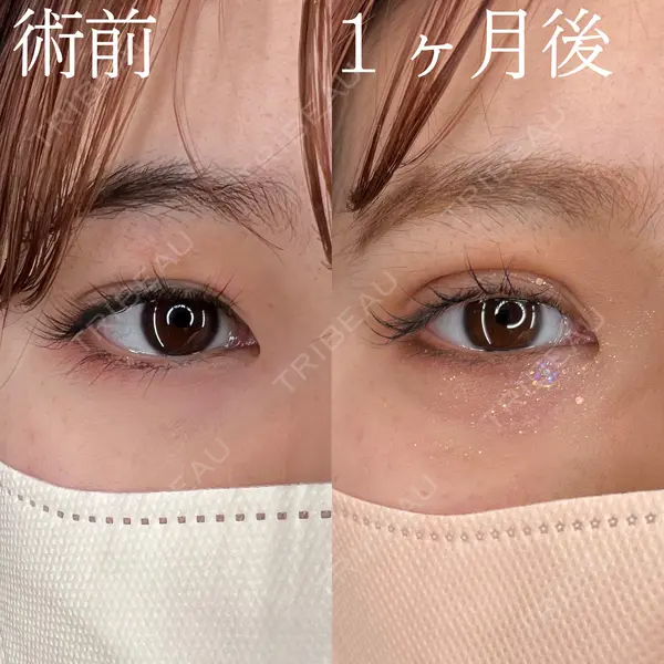 HAAB×DREAM BEAUTY CLINIC 大阪梅田院 柏木 太雅医師の症例
