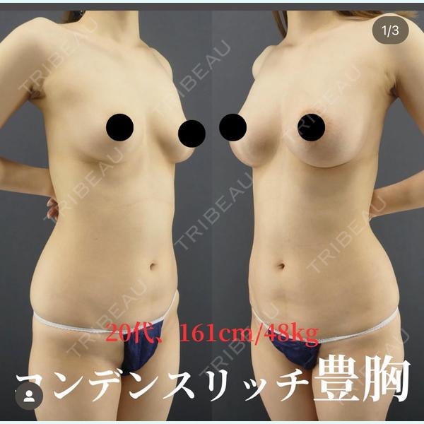 Casa de GRACIA GINZA 【カーサデグラシアギンザ】 樋口 隆男 理事長医師の症例