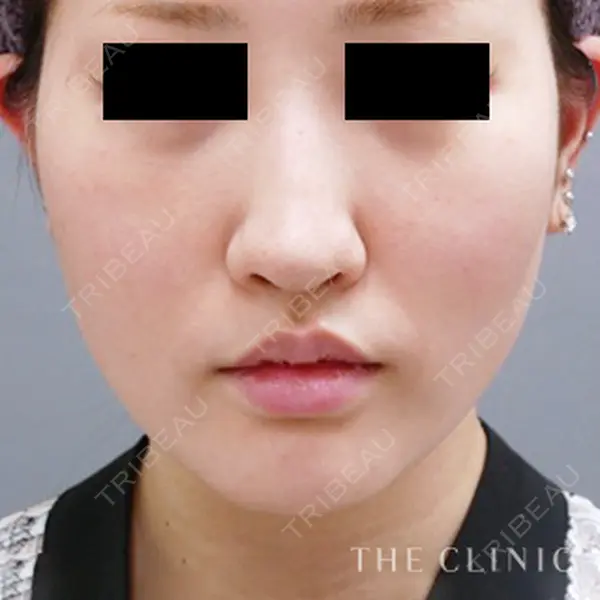 THE CLINIC（ザ・クリニック） 福岡院の症例