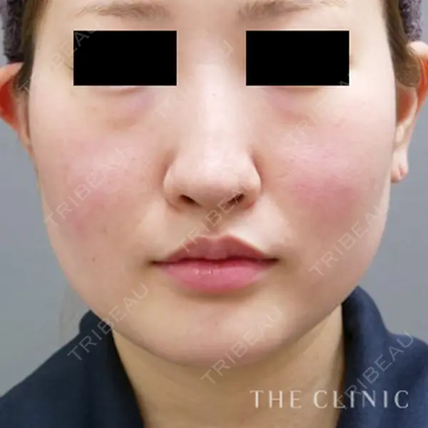 THE CLINIC（ザ・クリニック） 福岡院の症例