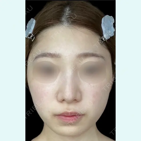 YAE C5 CLINICの症例