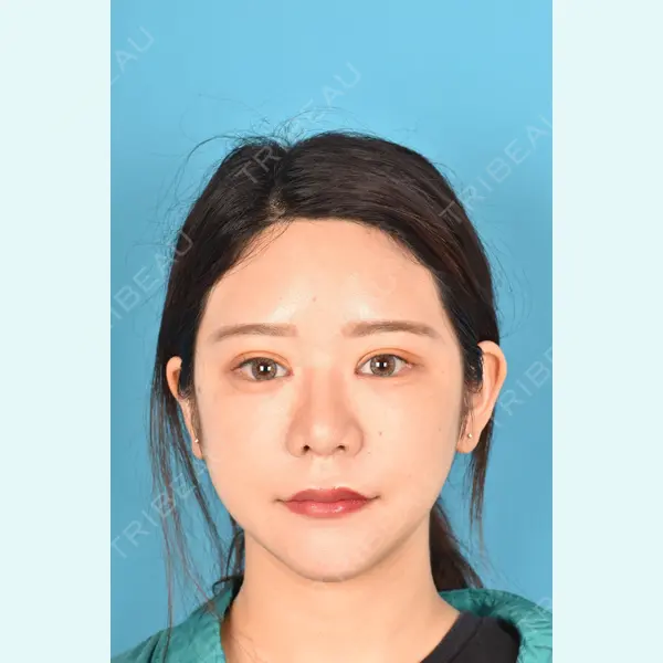 アネシス美容クリニック 水野　力医師の症例