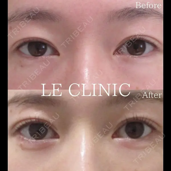 LE CLINIC 喜多　俊博医師の症例