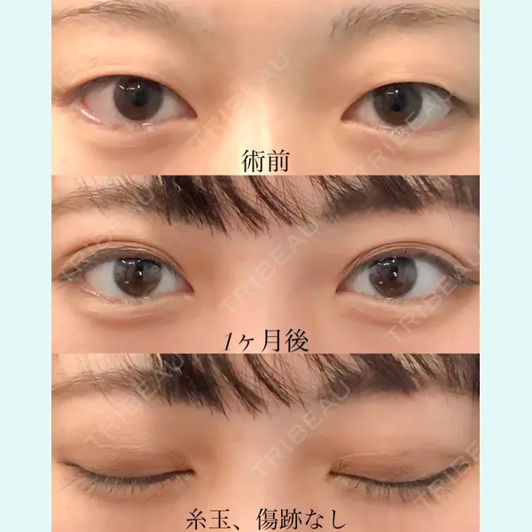 湘南美容クリニック 千葉センシティ院 高橋 淳医師の症例