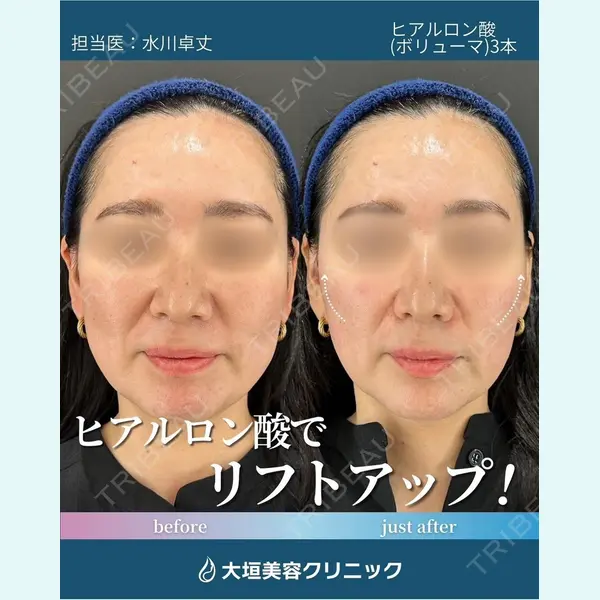 大垣美容クリニック 水川 卓丈医師の症例