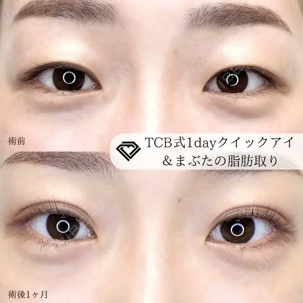 TCB東京中央美容外科 高崎院の症例